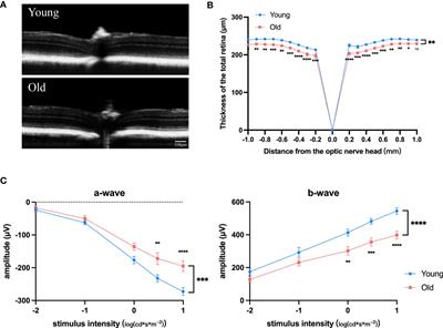 SPI1-mediated macrophage polarization aggravates age-related macular degeneration